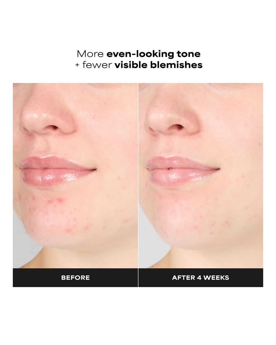 Paula's Choice Sking Perfecting Lotion Exfoliante Gel 1 % BHA 100 ML 5