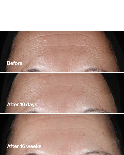 CLINIQUE CLINIQUE SMART CLINICAL REPAIR™ WRINKLE CORRECTING SERUM SÉRUM ANTI-ÂGE 50 ML