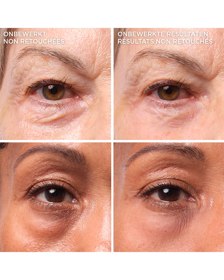 IT COSMETICS BYE BYE UNDER EYE BYE BYE UNDER EYE BAGS 15 ML 2