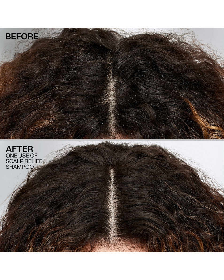 REDKEN Scalp Relief Shampooing antipelliculaire - pour cheveux secs 250 ML 2