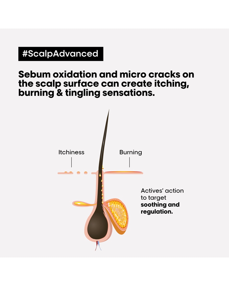 L'OREAL PROFESSIONNEL Scalp Advanced Shampooing dermo-régulateur anti-inconfort 300 ML 2