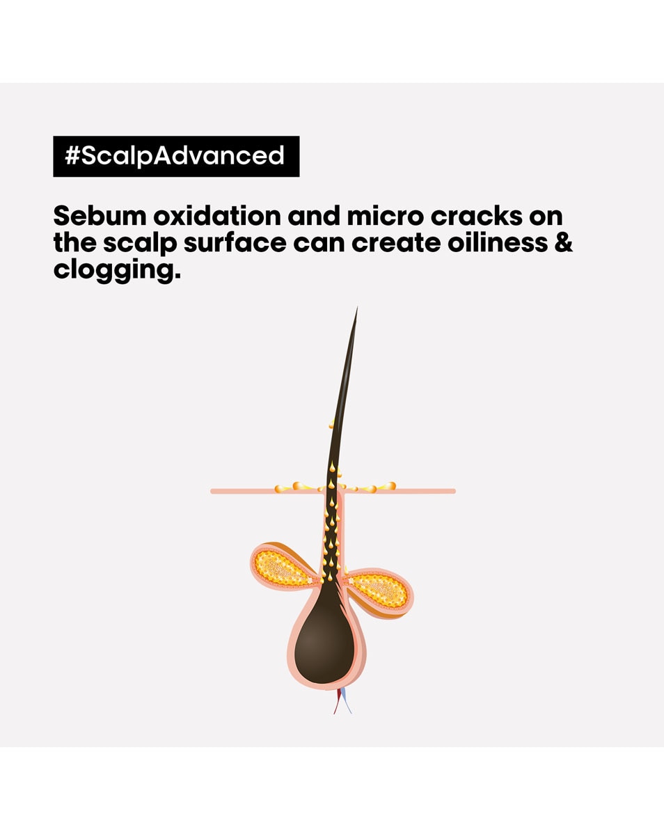 L'OREAL PROFESSIONNEL Scalp Advanced Shampooing dermo-purifiant anti-sébum 300 ML 2