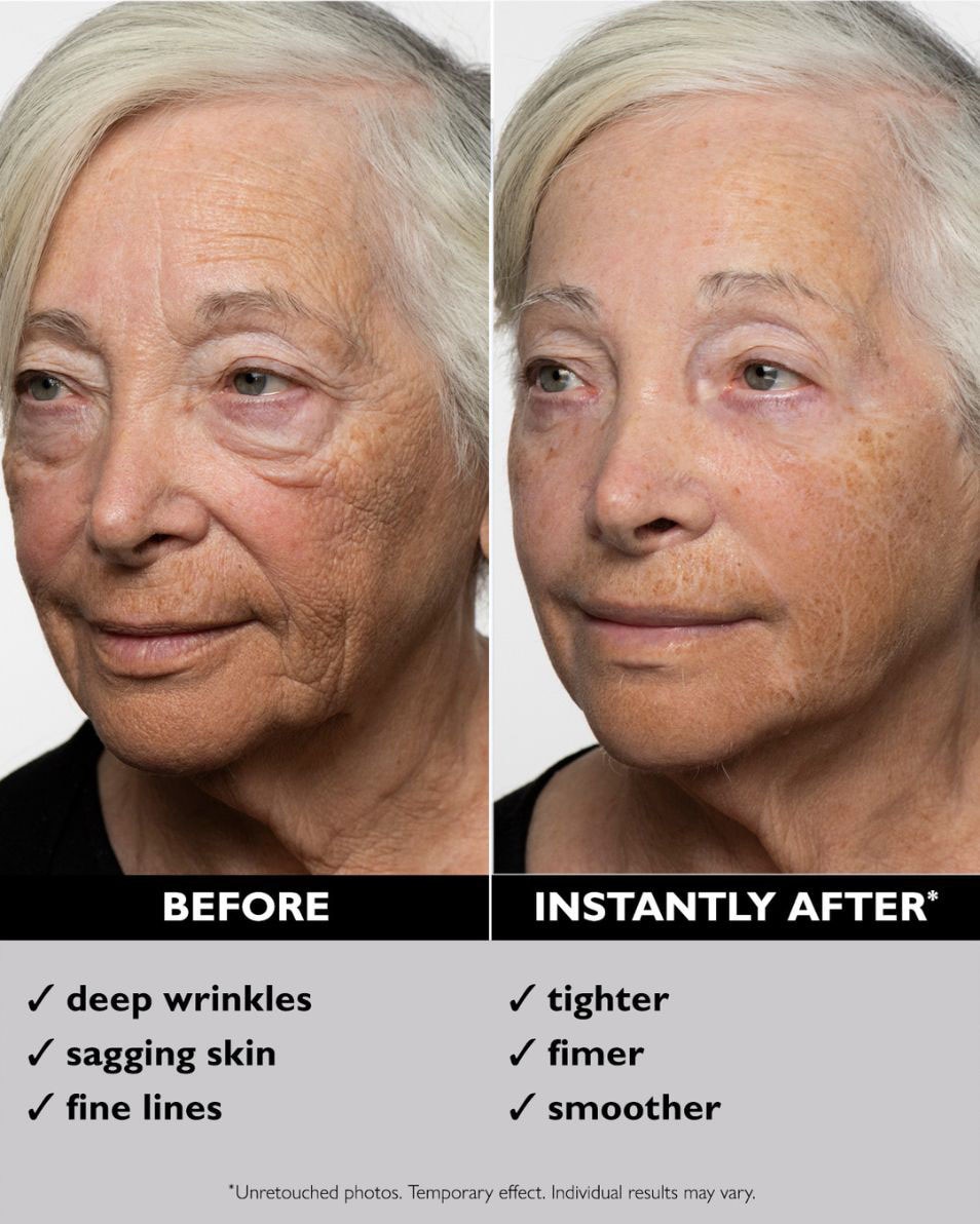 Tijdelijke Gezichtsverstrakker Gel