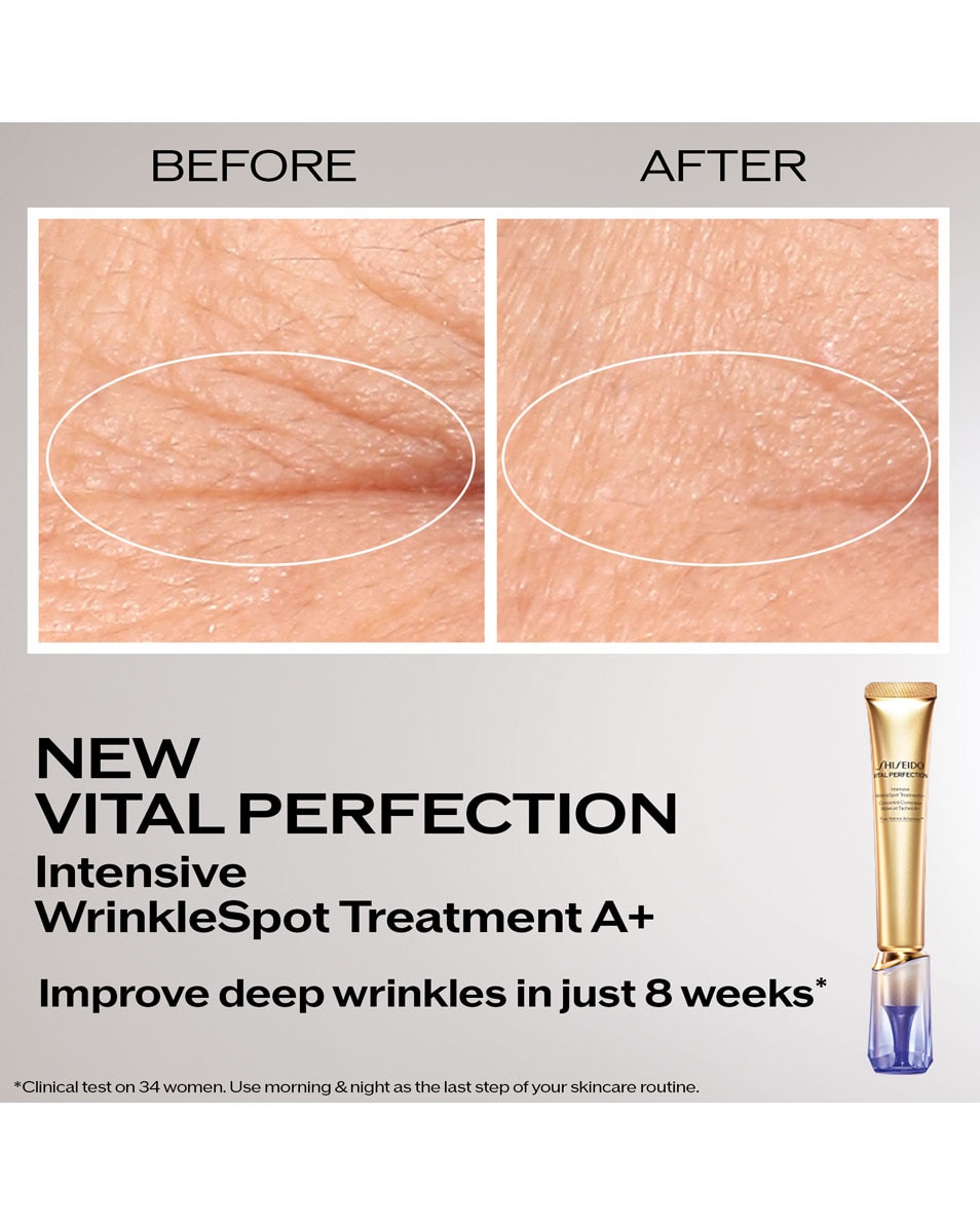 SHISEIDO Vital Perfection Intensive WrinkleSpot Treatment A+ 20 ML 2